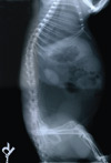 Side x-ray